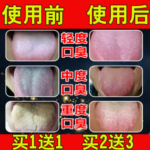 舌苔厚白调理女士 舌苔厚白调理女士品牌 价格 阿里巴巴 舌苔厚白调理女士 舌苔厚白调理女士品牌 价格 阿里巴巴