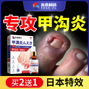 指甲沟炎息肉去除消炎嵌甲脚趾甲专用指软化剂矫正液药膏往肉里长