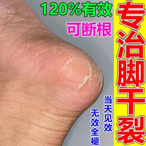 专治脚裂脚后跟干裂口修复霜手起硬皮脱皮真菌感染冻龟裂防脚裂膏
