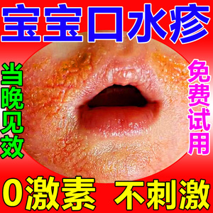 口水疹膏婴儿宝宝专用宝宝预防儿初宝口水疹膏修护膏神器面霜药膏