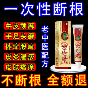 苗家牛皮癣银屑病股藓湿疹止痒去根外用皮肤瘙痒抑菌专用特效药膏