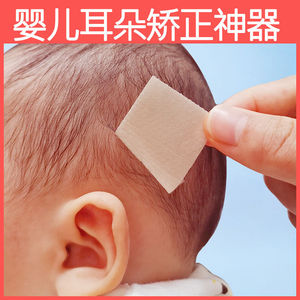 婴儿耳朵矫正器新生儿宝宝招风耳卷耳定型矫正防压纠正固定贴神器
