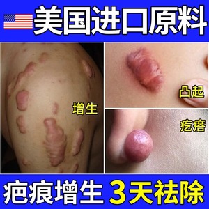 祛疤膏去疤痕贴烫伤剖腹产修复除疤膏疤克巴克儿童旗舰店官方正品