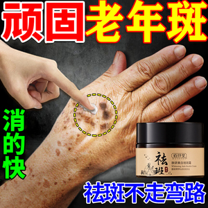 去手上老人斑专用药面霜膏强力去除老年斑祛手部脸部淡黑班黄褐斑