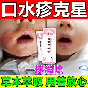 口水疹膏婴儿宝宝专用预防初宝下巴唇周修护神器外用止痒抑菌乳膏