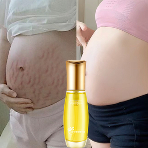 橄榄油妊娠预防孕妇妊辰纹专用护淡化用的止痒产后消除去紧致肚皮