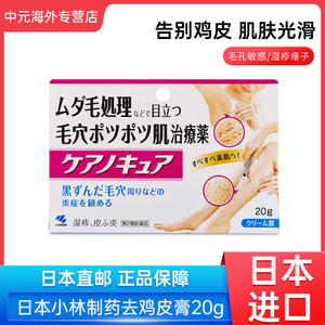 日本小林制药湿疹皮炎软膏缓解痱子斑疹腿部去鸡皮膏20g真菌