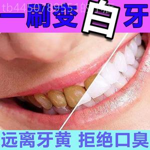 牙菌斑祛除神器儿童牙齿发黑去牙渍牙垢黄牙速效除氟斑牙专用牙粉