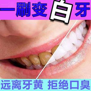 牙菌斑祛除神器儿童牙齿发黑去牙渍牙垢黄牙速效除氟斑牙专用牙粉