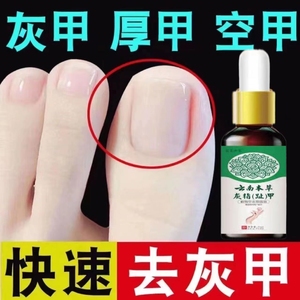 灰指甲特效脱甲精油抗真菌感染软化药膏非进口剪刀脚指甲药水买二