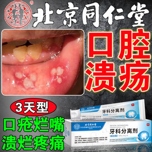 口腔溃疡专用牙膏嘴上火除口臭防牙周炎去异味牙龈出血生口疮溃烂