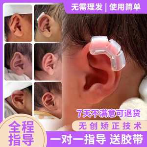 耳朵矫正器婴儿新生的儿耳贴硅胶外耳垂耳招风耳耳夹辅助定型器材