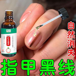 指甲长黑线黑指甲竖纹专用修复液手脚指甲有黑色淤血灰指甲分离厚