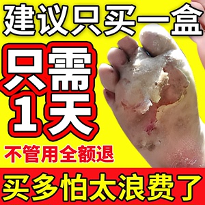 脚气专用药膏喷雾治疗脚痒脱皮烂脚丫水泡型根治止痒杀菌真菌感染