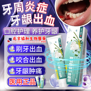 改善防牙龈出血专用可搭牙膏三七止血治疗牙出血吃什么漱口水UP