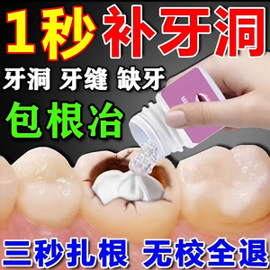 美国进口3m树脂补牙材料堵假牙齿洞膏神器牙缝蛀牙填充复合胶粉