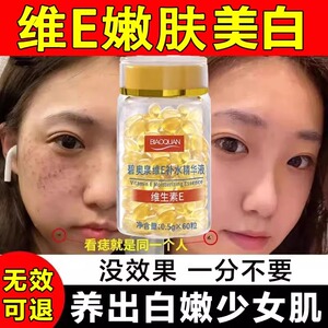 维生素e胶囊美白淡斑去黄气提亮肤色改善暗沉脸色黄维生素e乳正品