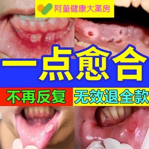 口腔溃疡专用药贴特效药凝胶喷剂一点灵散粉蜂胶软膏冰硼散含片