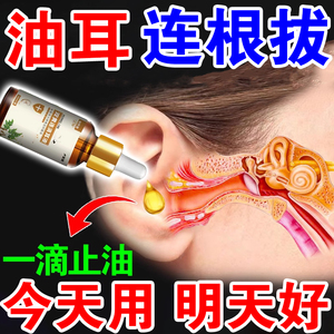 油耳朵清洁器专用滴耳液儿童成人耳堵耳屎软化耵聍吸耳止痒清神器