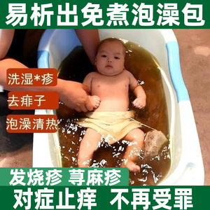 宝宝婴儿湿疹泡澡药包专门用干性湿疹奶癣红斑去痱子儿童止痒膏