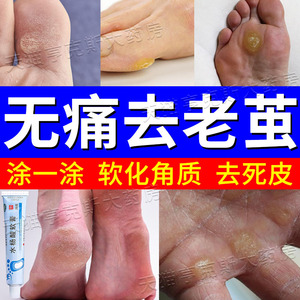 去老茧药膏水杨酸软膏正品软化角质去手脚死皮脚底脚跟硬皮增厚