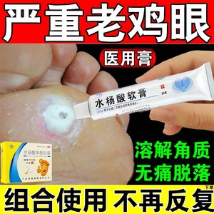 水杨酸软膏正品软化角质治疗鸡眼药膏去除脚上鸡眼贴角质增生鸡皮