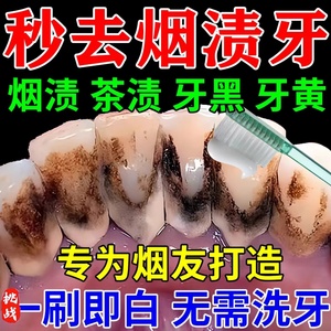 强力去烟渍牙膏牙渍牙垢黄牙速效洗牙齿污垢除牙结石神器茶牙克星