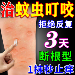 日本蚊虫叮咬快速止痒消肿儿童专用婴儿宝宝成人夏季防止叮咬药膏