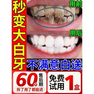 牙斑净牙菌斑祛除神器齿美白速效去黄除烟渍氟斑牙专用牙膏旗舰店