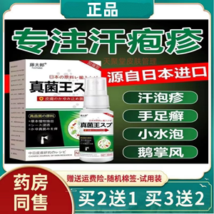 汗泡疹汉状真菌感染手气膏手上起小水泡干裂手痒脱皮皮肤外用喷剂