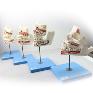 ENOVO正品儿童牙列与颌骨发育模型乳牙恒牙幼儿口腔牙齿保健模型