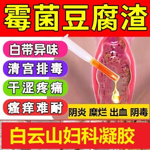 霉菌性阴炎豆腐渣反反复复妇科炎癥用药阴道炎去异味抑菌凝胶正品