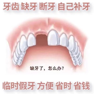 自制假牙单颗套仿真烤瓷一颗饰牙缝牙齿门牙缺牙材料新款上市树脂