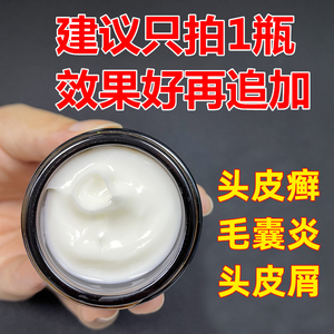 头癣银屑癣毛囊炎专用药头部外用头皮真菌克星抑菌乳膏药膏特效药