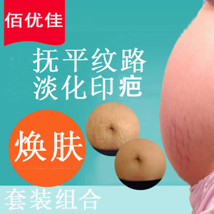 妊娠纹修护霜 淘宝拼多多热销妊娠纹修护霜货源拿货 阿里巴巴货源