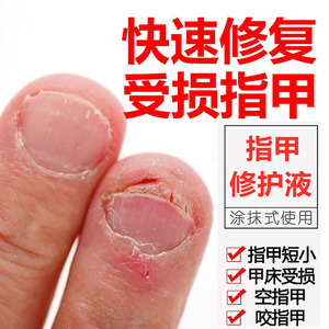 受损指甲增厚修复凹凸生长液美甲修复液再生营养油手指脚趾甲重生