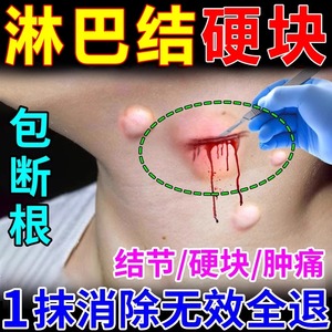 淋巴结消散膏肿大散结贴去副乳神器特效药疏通腋下颈部耳后专用ZW