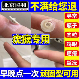 疣清宁疣候去疣寻常去除神瘊器水尤瘊小肉粒一抹无忧可搭膏药贴TF