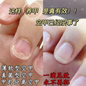 治指甲空甲修复液受损再生甲床甲肉分离专分层养剥增长生长手脚趾