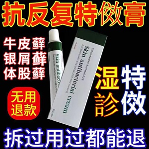 特效药专治顽固牛皮藓癣头皮癣银屑病皮疹足藓止痒古方药膏