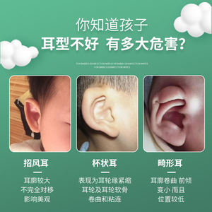 婴儿耳朵矫正器纠正新生的儿耳廓贴定型贴宝宝防压神器招风耳硅胶