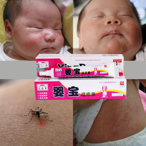 婴宝湿霜疹婴儿宝宝奶癣热疹药膏荨麻疹止痒儿童蚊虫叮咬抑菌乳膏