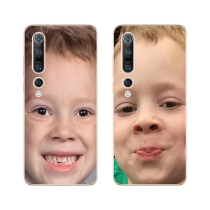 假笑男孩Gavin大脸搞怪表情适用于小米10/10Pro手机壳软保护套