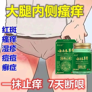 云南止痒膏根肛周去阴囊抑菌皮肤瘙痒男女用外阴私处大腿内侧