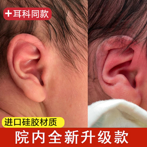 新生婴儿耳朵矫正器宝宝垂耳廓畸形招风耳纠正贴耳夹定型矫正神器