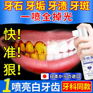 牙斑净牙粉牙齿美白速效擦去牙结石黄牙烟茶渍牙菌斑垢洗祛除神器