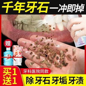 牙结石去除器速效漱口水洗牙齿污垢牙黄牙垢溶解牙石渍清除神器P6