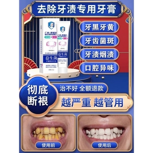 强力去烟渍牙膏洗牙粉清洁牙渍牙垢黄牙结石克星溶解专用美白神器
