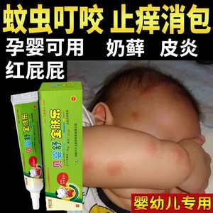 江西越洋千年奇草止痒膏正品官方旗舰店生物抑菌乳膏皮肤宝宝药店