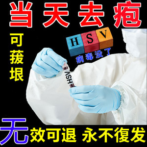 生殖男器疱疹女私处性病hsv2克星病毒膏泡疹防复发带状断根日本